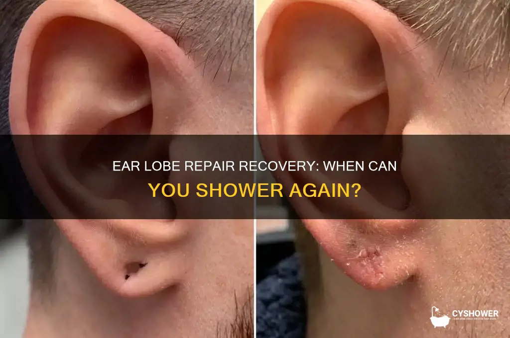 how long after ear lobe repair can take a shower