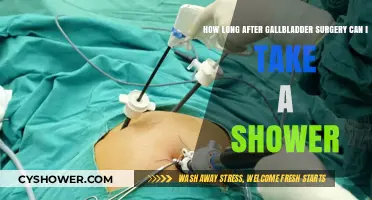 Post-Gallbladder Surgery Shower Guidelines: When Can You Safely Shower?