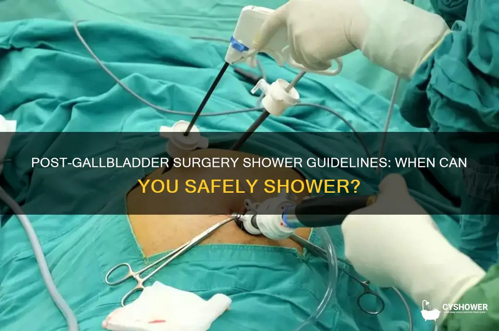 how long after gallbladder surgery can i take a shower