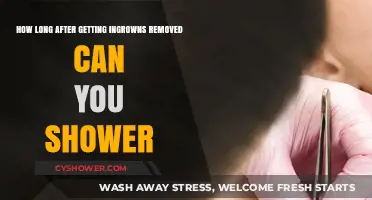 Post-Ingrown Removal: When Can You Safely Shower Again?