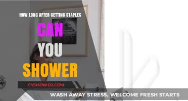 Post-Staple Shower Guidelines: When It’s Safe to Get Wet Again