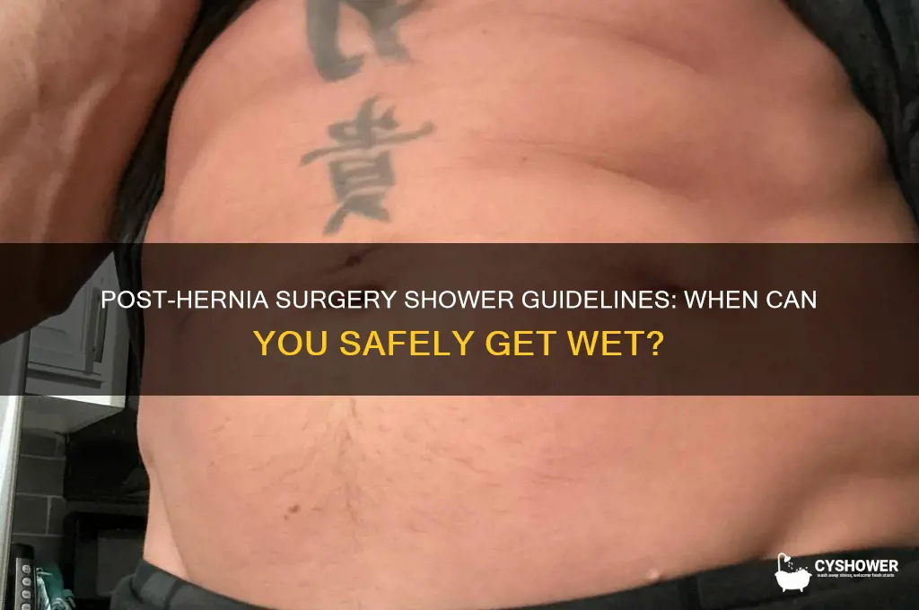 how long after hernia surgery can i take a shower