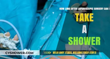 Post-Laparoscopic Surgery Shower Guidelines: When Can You Safely Get Wet?