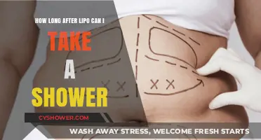 Post-Lipo Shower Guide: When Can You Safely Get Wet Again?