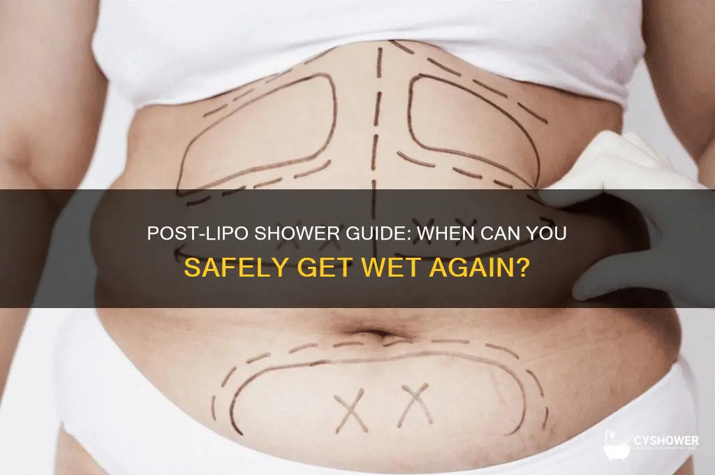 how long after lipo can i take a shower