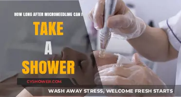 Microneedling Aftercare: When Can You Shower Safely?