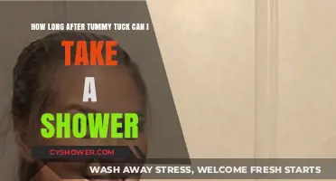 Post-Tummy Tuck Shower Guide: When Can You Safely Shower Again?
