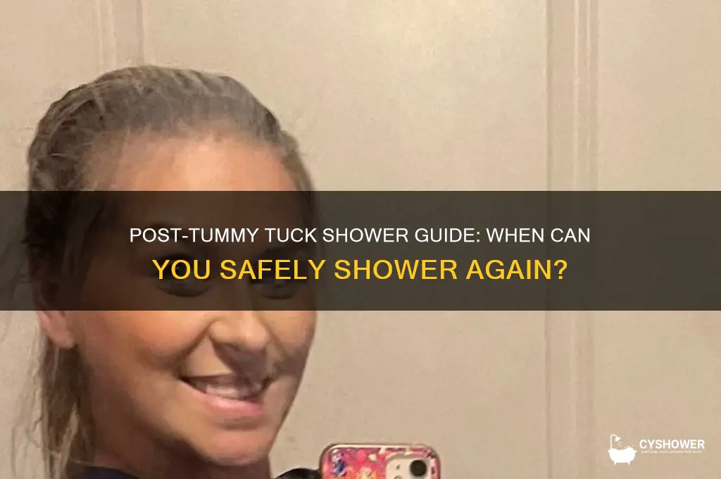 how long after tummy tuck can i take a shower