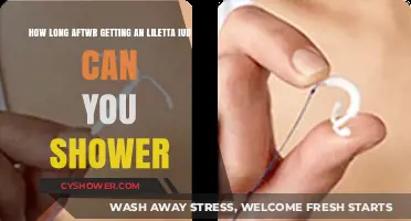 Showering After Liletta IUD Insertion: What You Need to Know