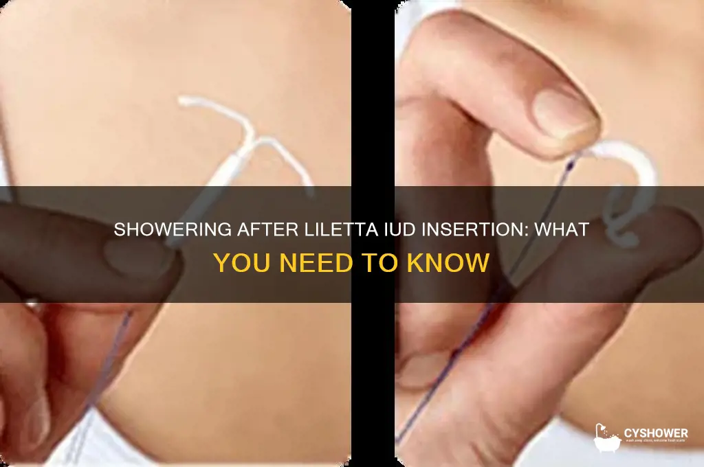 how long aftwr getting an liletta iud can you shower