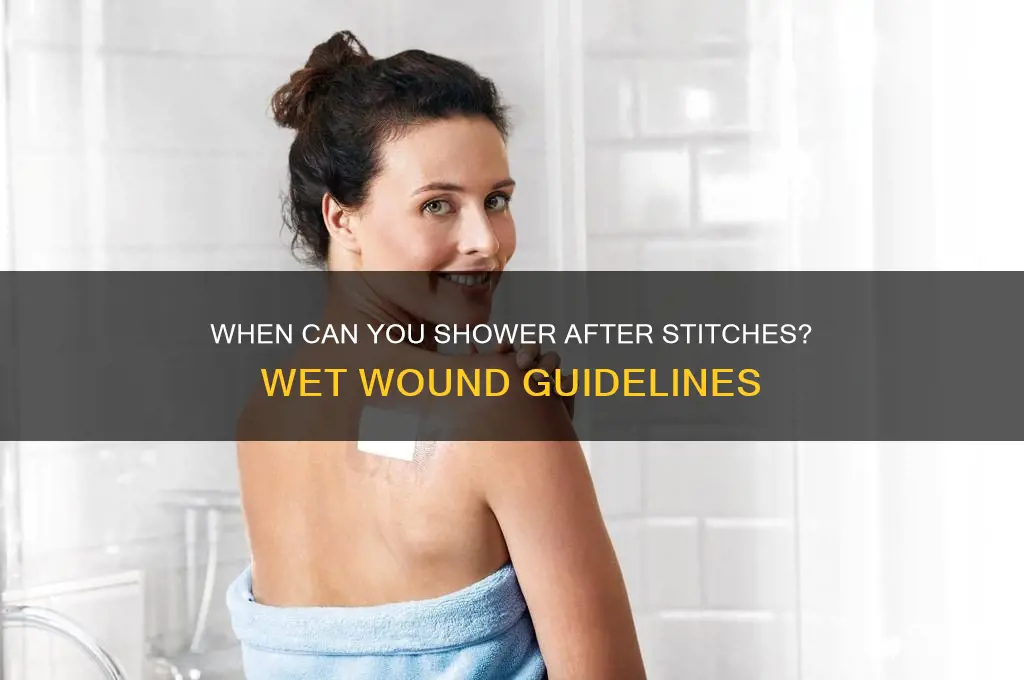 how long before i can shower and get stiches wet