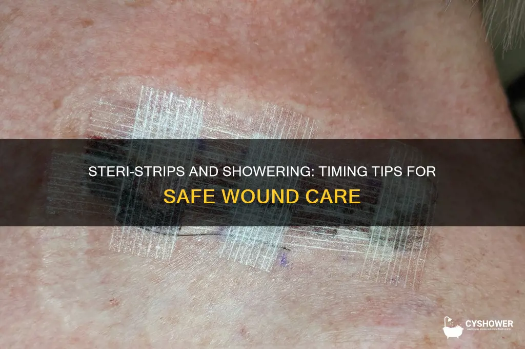 how long take a shower steri strips
