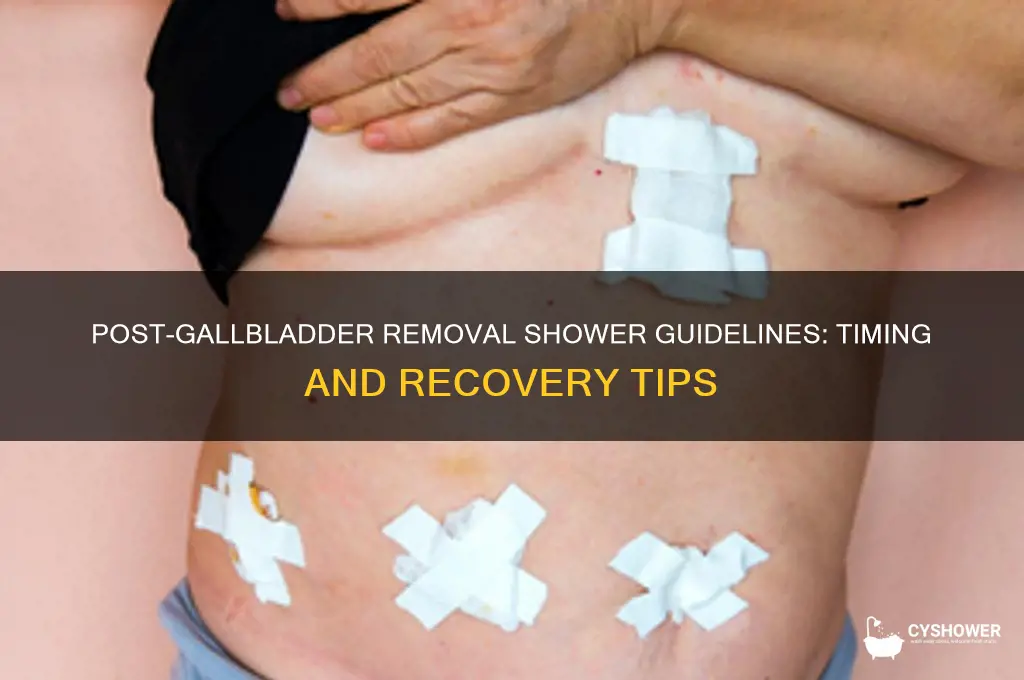 how long to wait to shower after gallbladder removal