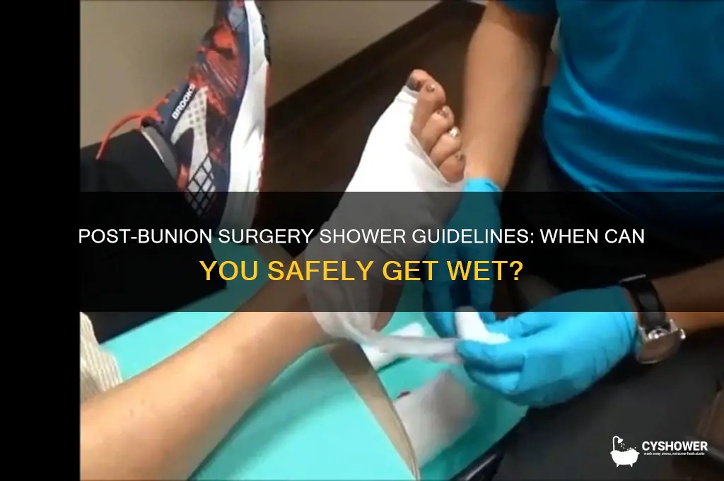 how soon can i shower after bunion surgery