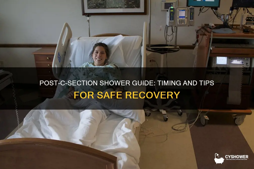 how soon can i shower after c section