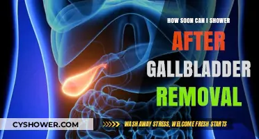 Post-Gallbladder Removal Shower Guidelines: When Can You Safely Shower?