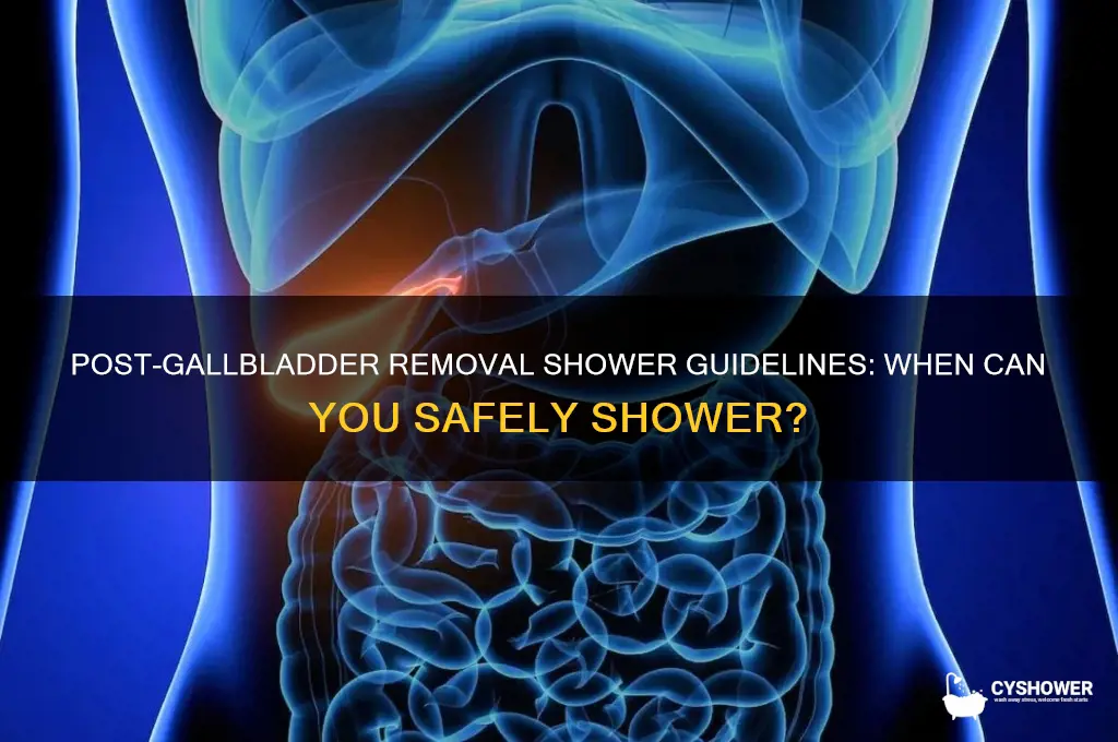 how soon can i shower after gallbladder removal