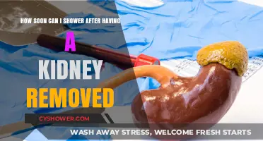 Post-Kidney Removal Shower Guidelines: When Can You Safely Get Wet?