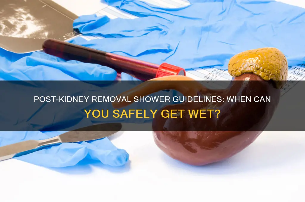 how soon can i shower after having a kidney removed