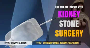 Post-Kidney Stone Surgery Shower Guidelines: Timing and Recovery Tips