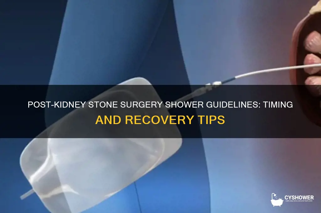 how soon can i shower after kidney stone surgery