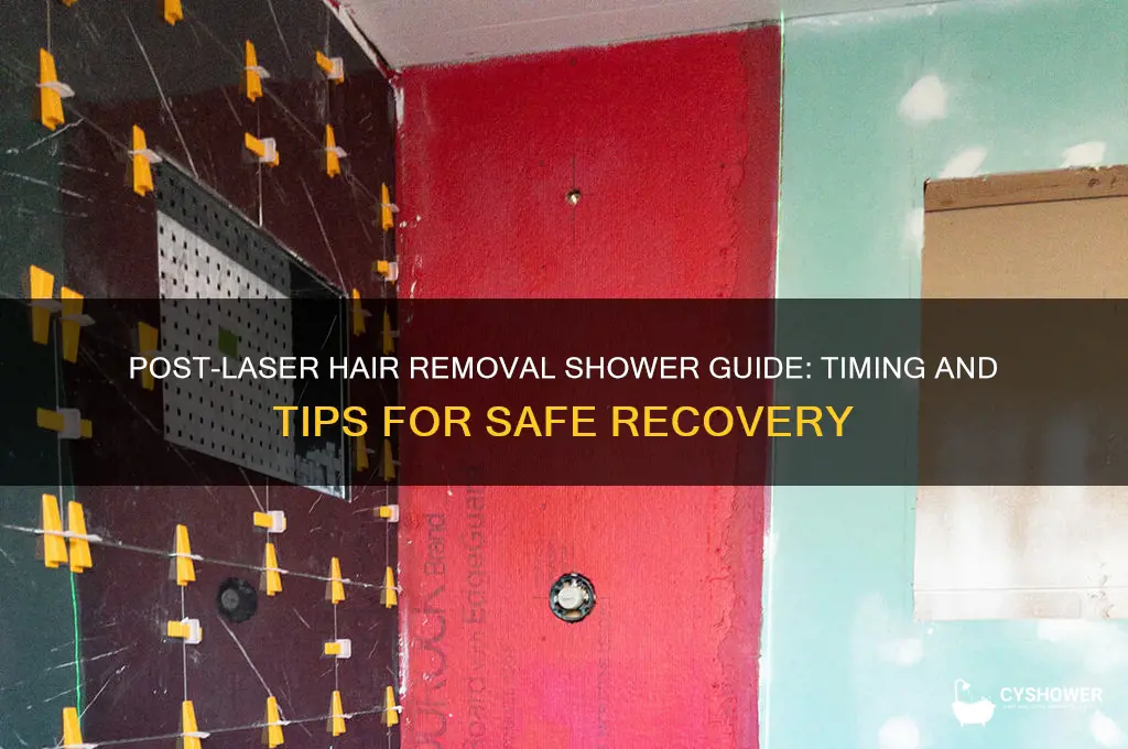 how soon can i shower after laser hair removal