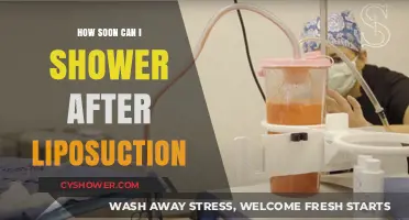Post-Liposuction Shower Guide: Timing and Tips for Safe Recovery
