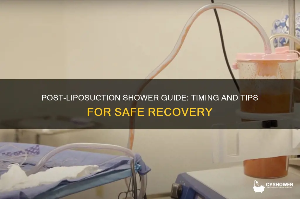 how soon can i shower after liposuction