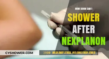 Showering After Nexplanon: Safe Timing and Post-Insertion Care Tips