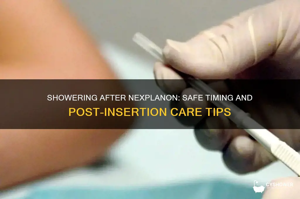 how soon can i shower after nexplanon