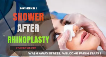 Post-Rhinoplasty Shower Guide: When It’s Safe to Lather Up