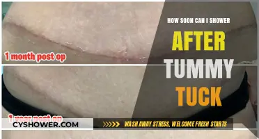 Post-Tummy Tuck Shower Guidelines: Timing and Recovery Tips