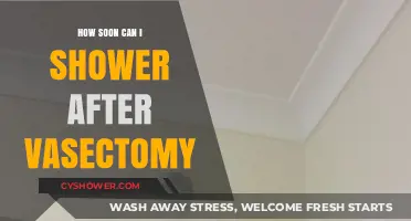 Post-Vasectomy Shower Guidelines: When Can You Safely Get Wet?