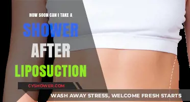 Post-Liposuction Shower Guidelines: When Can You Safely Get Wet?