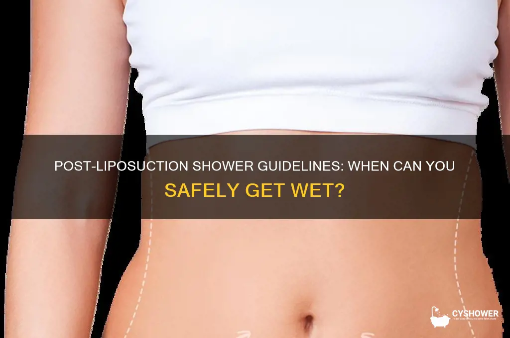 how soon can i take a shower after liposuction