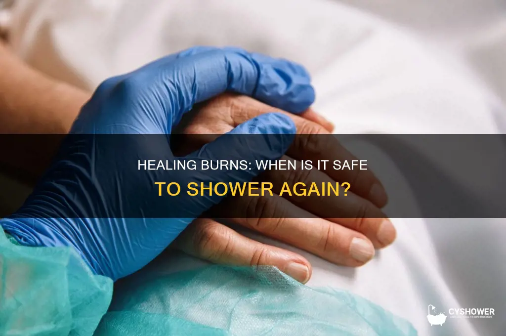 how soon can you shower after a burn