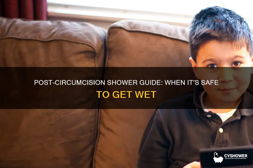 how soon can you shower after circumcision