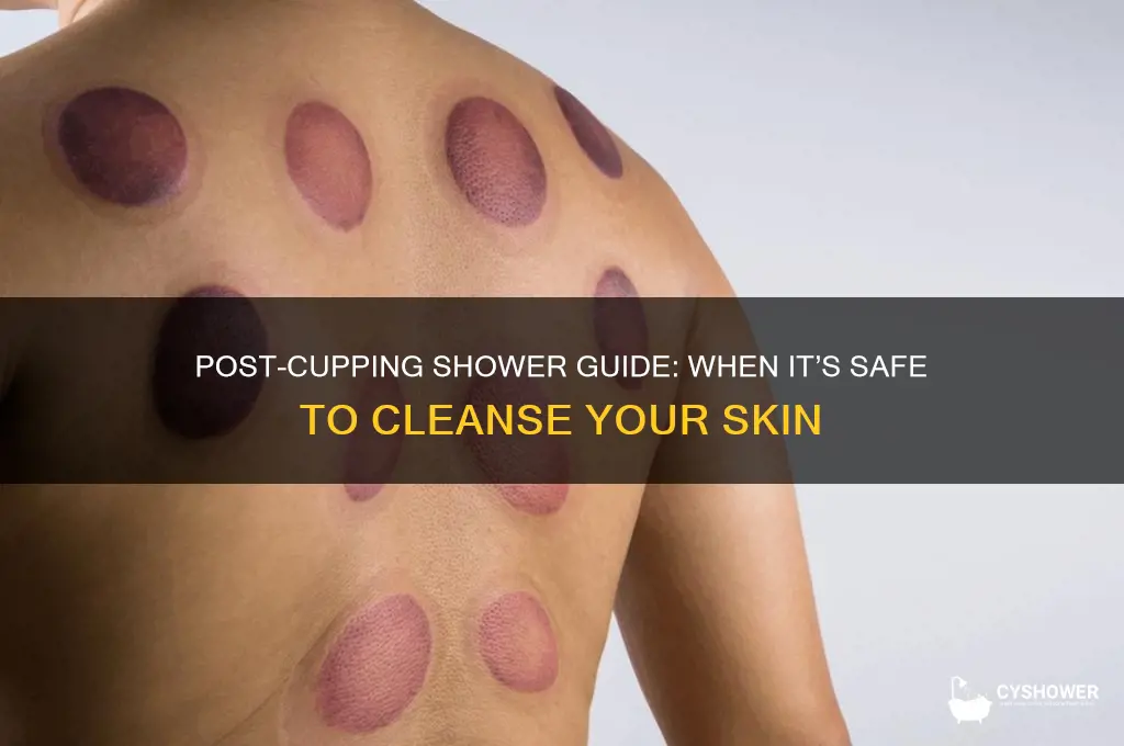 how soon can you shower after cupping