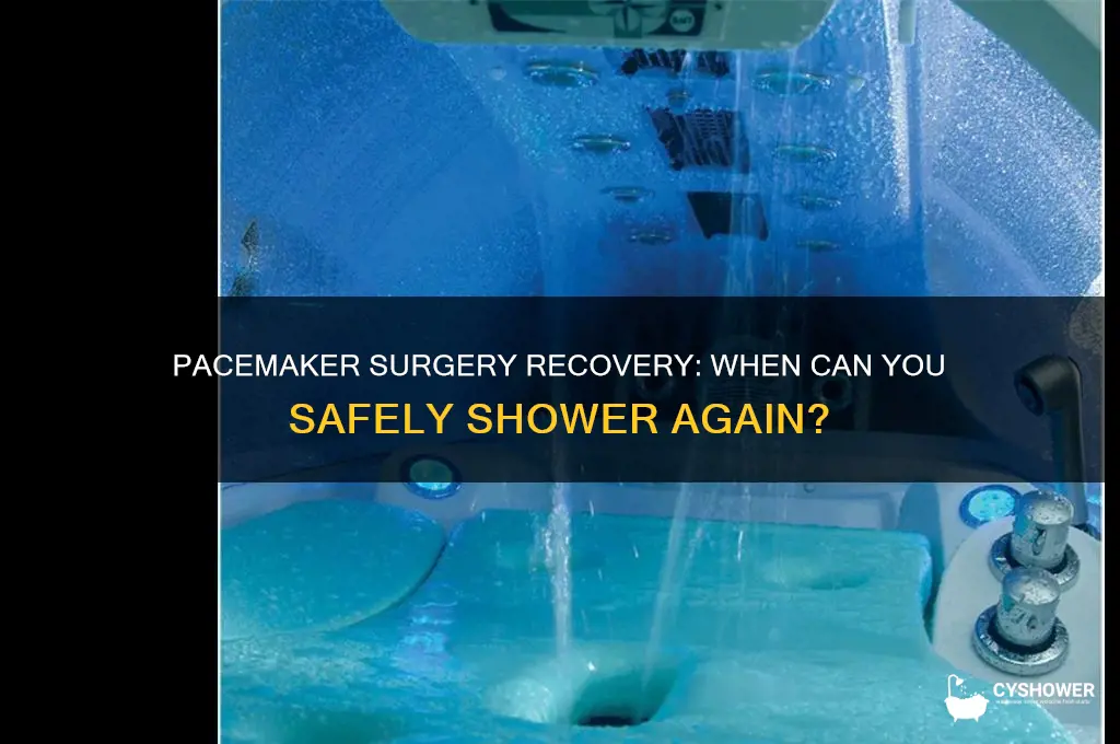 how soon can you shower after pacemaker surgery