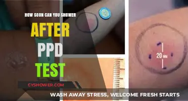 Post-PPD Test Shower Guidelines: When Can You Safely Shower?