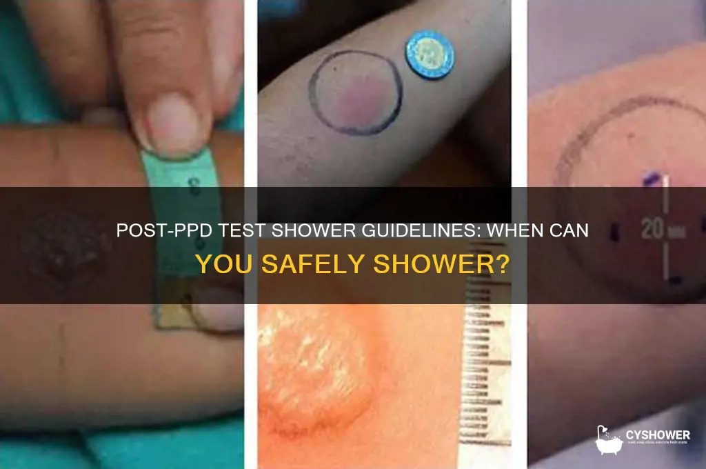 how soon can you shower after ppd test