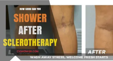 Post-Sclerotherapy Shower Guidelines: When Can You Safely Cleanse Again?