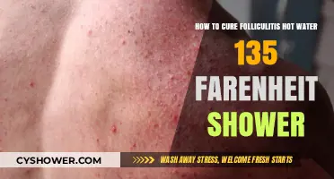 Heal Folliculitis with 135°F Hot Water Showers: A Simple Cure