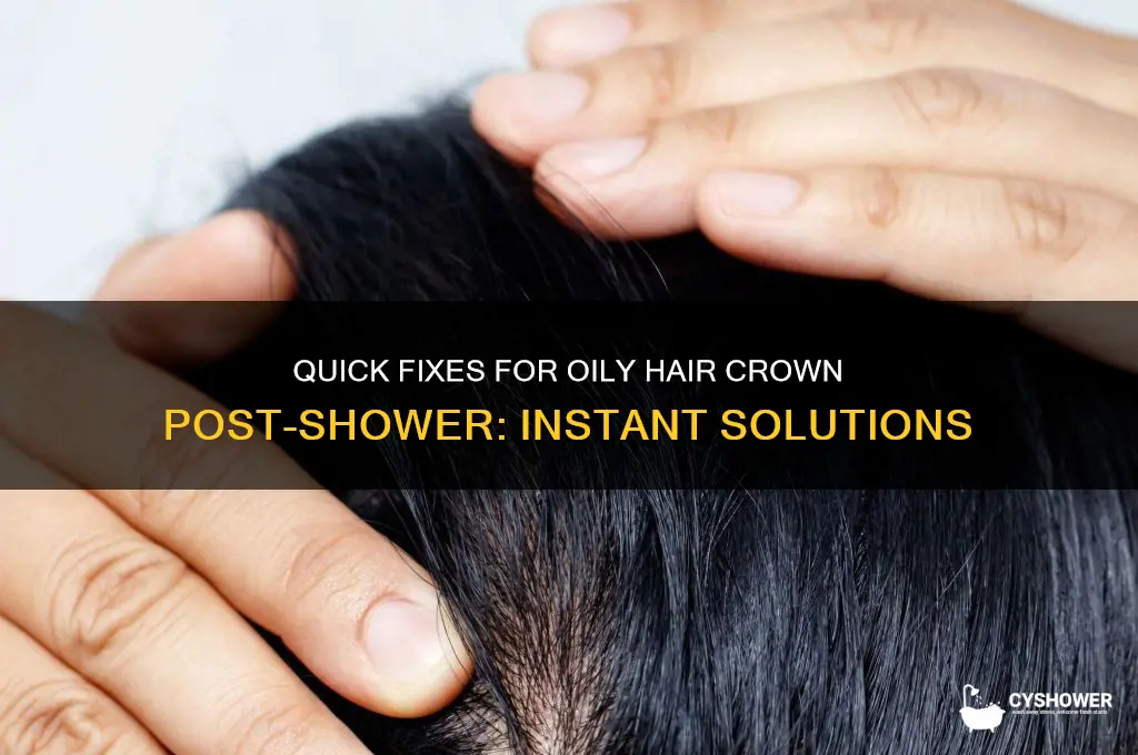 how to deal with oily hair crown immediately after shower