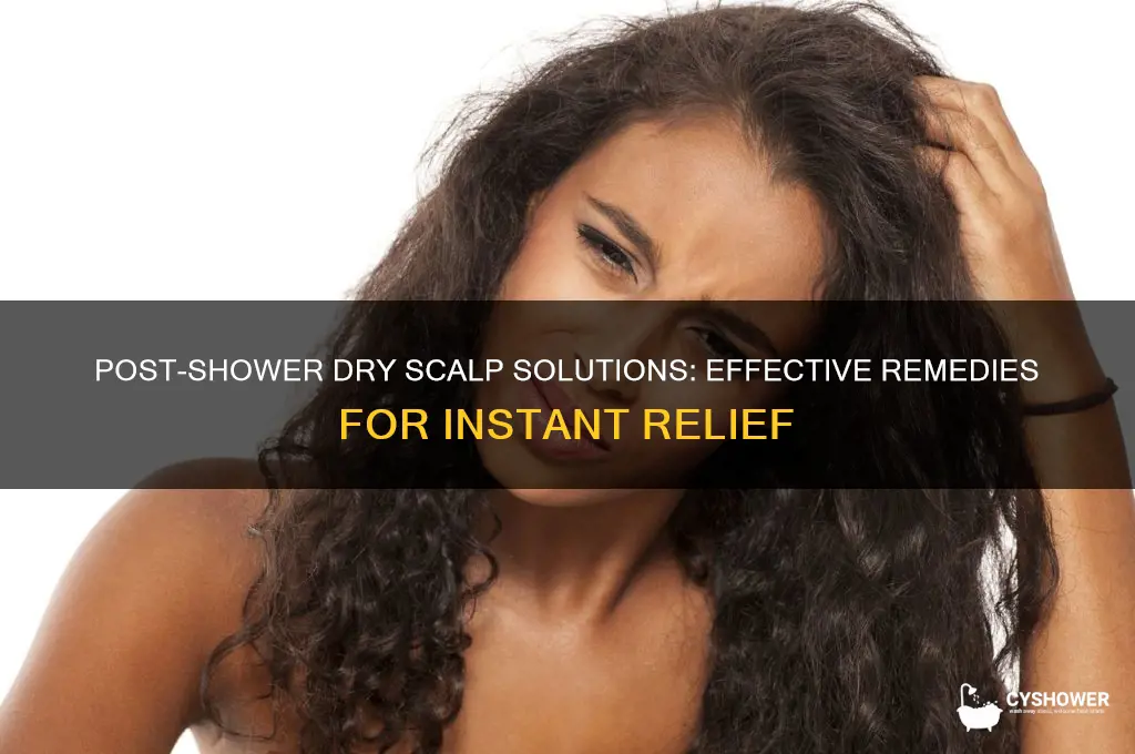 how to fix dry scalp after shower