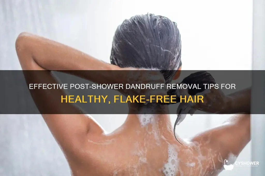 how to get dandruff out of hair after shower
