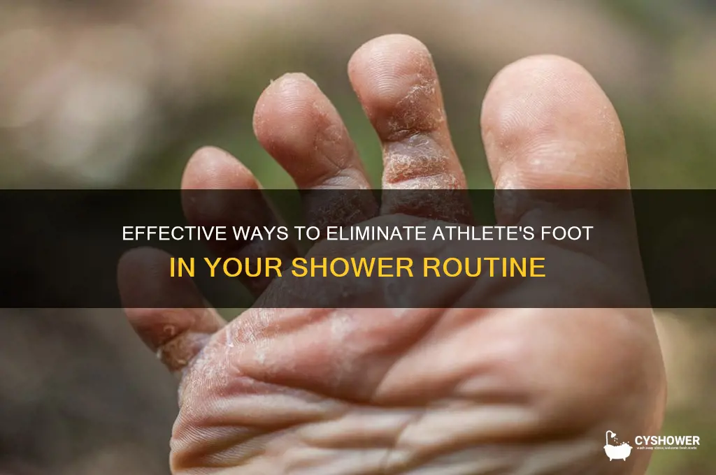 how to get rid fo athlees foot shower