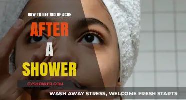 Post-Shower Acne Solutions: Clear Skin Tips for a Fresh Glow