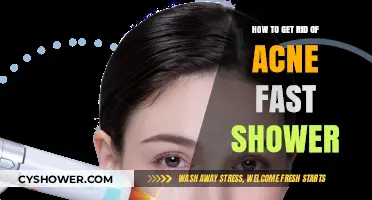 Quick Acne Relief: Effective Shower Tips for Clear Skin Fast