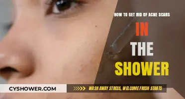 Shower Secrets: Effective Ways to Fade Acne Scars Naturally